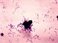 

Streptococcus mutans jest bakterią gram dodatnią to znaczy, że barwiona
tzw. metodą Grama barwi się na fioletowo (fot. CDC)


